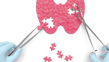How MegaSporeBiotic can heal your thyroid